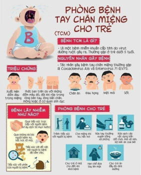 Khuyến cáo phòng chống dịch tay chân miệng